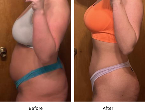 Semaglutide Before & After at JK MedSpa Columbus NE